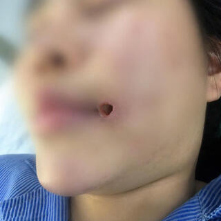 <a href="/tin-tuc-su-kien/bai-viet-chuyen-mon" title="Bài viết chuyên môn" rel="dofollow">HOẠT ĐỘNG CHUYÊN MÔN</a>