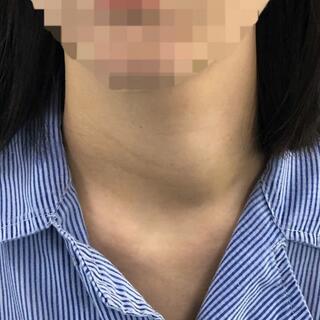 <a href="/tin-tuc-su-kien/bai-viet-chuyen-mon" title="Bài viết chuyên môn" rel="dofollow">HOẠT ĐỘNG CHUYÊN MÔN</a>